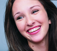 Invisalign Model
