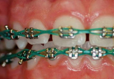 Power Chain
